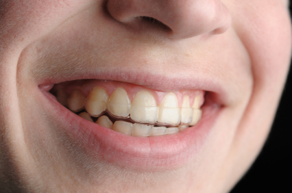 Orthodontics