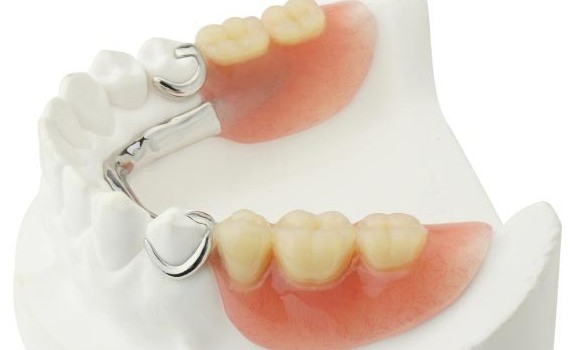 denture-dental-prosthesis-04